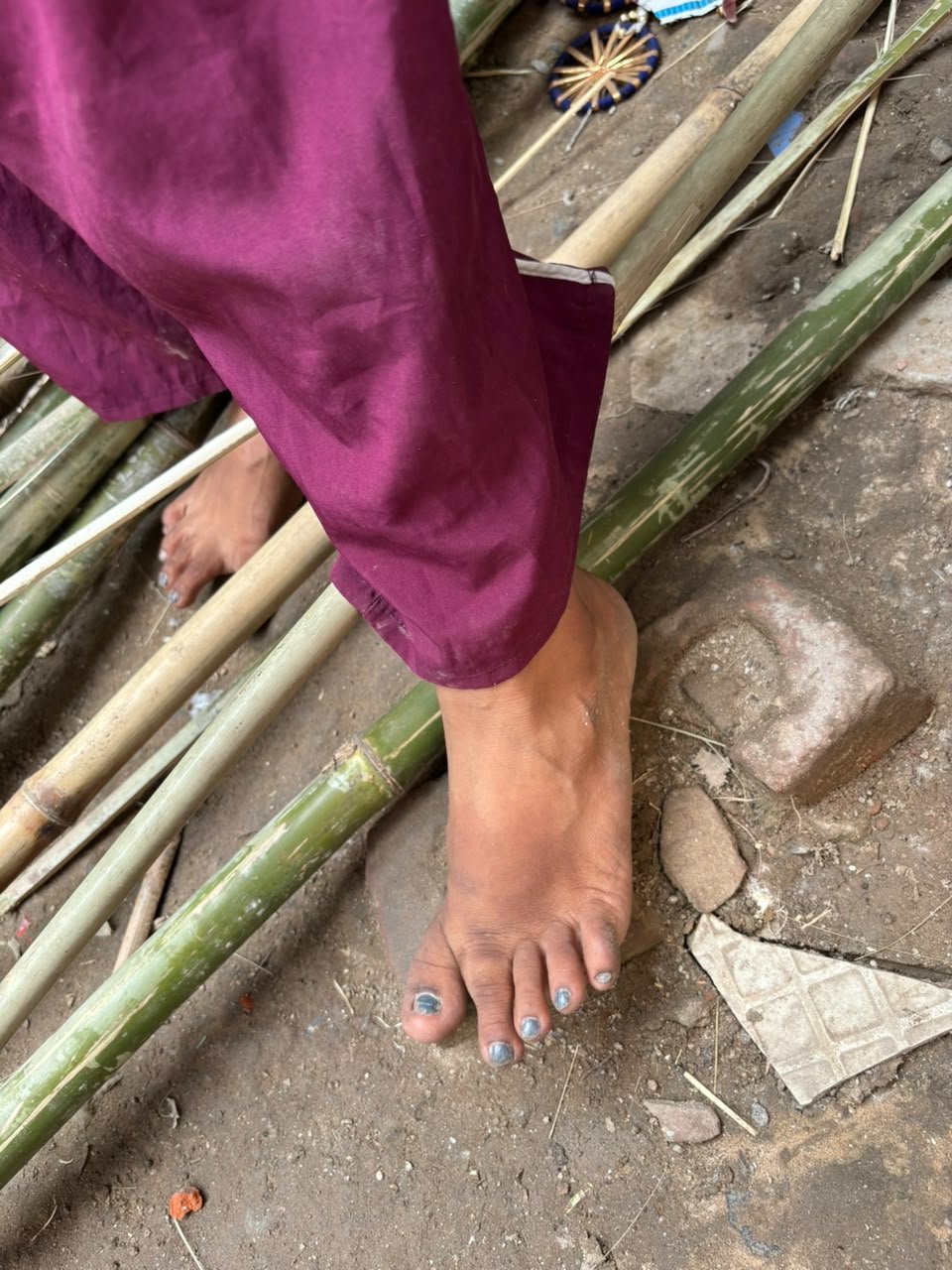 Community support